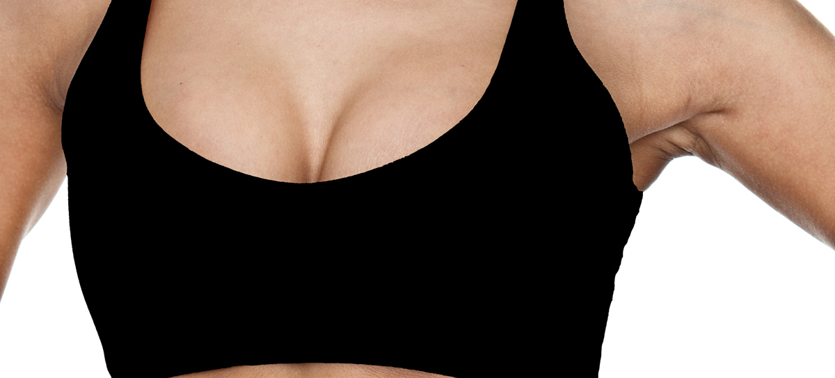 Breast Augmentation New Hampshire Dr. Marble